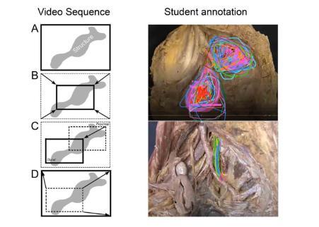 Cadaver dissection camera angles